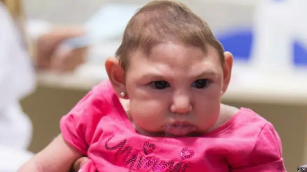 كل ما تحتاج معرفته عن فيروس زيكا كل ما تحتاج معرفته عن فيروس زيكا