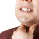 كل ما تحتاج لمعرفته عن سرطان الفم: أسباب، أعراض وعلاجات
