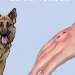 داء الكلب: الفهم الشامل والعلاج الفعال داء الكلب: الفهم الشامل والعلاج الفعال