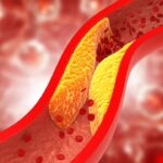 اكتشف السرّ: مشروب فعّال للتخلص من الكوليسترول اكتشف السرّ: مشروب فعّال للتخلص من الكوليسترول