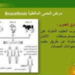 الحمى المالطية: الأسباب والأعراض والوقاية الحمى المالطية: الأسباب والأعراض والوقاية