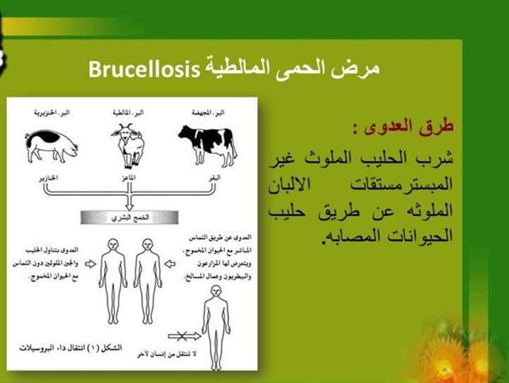 الحمى المالطية: الأسباب والأعراض والوقاية الحمى المالطية: الأسباب والأعراض والوقاية