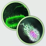 الكوليرا: الأسباب، الأعراض، والوقاية الفعالة الكوليرا: الأسباب، الأعراض، والوقاية الفعالة