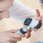 اكتشف أسرار الأكياس الدهنية وطرق التخلص منها