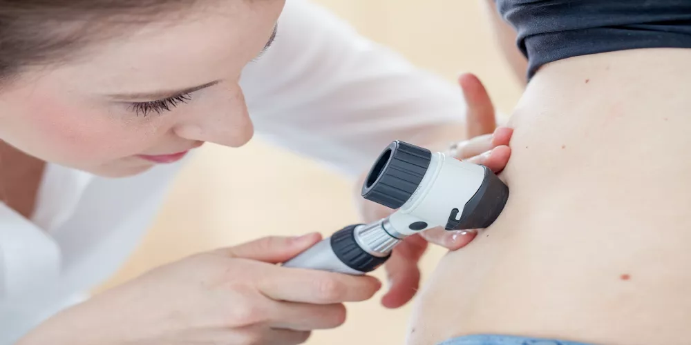 اكتشف أسرار الأكياس الدهنية وطرق التخلص منها