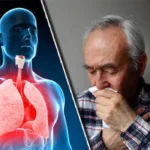 كل ما تحتاج لمعرفته عن التهاب الشعب الهوائية: دليل شامل