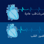 استكشاف أسرار قصور القلب: دليل شامل لأعراضها وعلاجها استكشاف أسرار قصور القلب: دليل شامل لأعراضها وعلاجها