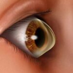 القرنية المخروطية: الأسباب والأعراض والعلاج