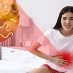 البلهارسيا: الأسباب والعلاج والوقاية البلهارسيا: الأسباب والعلاج والوقاية