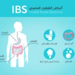 كل ما تحتاج معرفته عن القولون العصبي كل ما تحتاج معرفته عن القولون العصبي