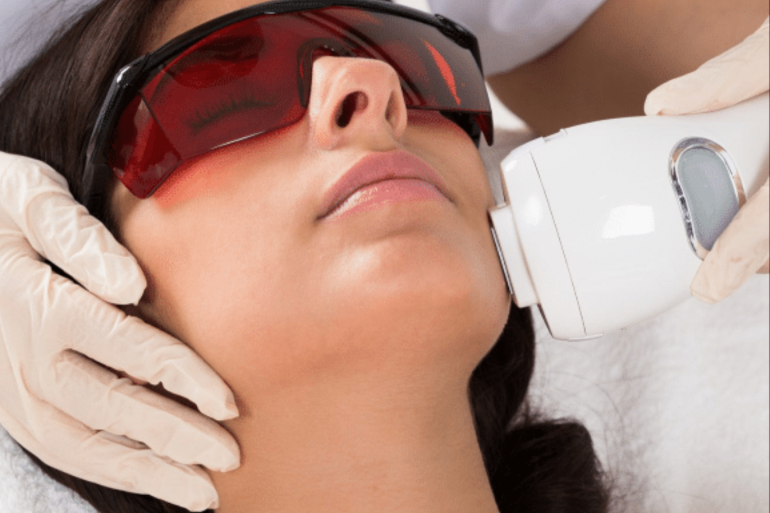 الكل ما تحتاج معرفته عن إزالة الشعر بالليزر الكل ما تحتاج معرفته عن إزالة الشعر بالليزر