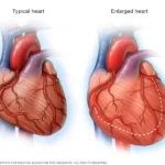 فهم شامل لفشل القلب: الأسباب والتشخيص والعلاج فهم شامل لفشل القلب: الأسباب والتشخيص والعلاج