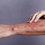 فيروس نقص المناعة البشري ومرض الإيدز: الأسباب والأعراض والوقاية فيروس نقص المناعة البشري ومرض الإيدز: الأسباب والأعراض والوقاية