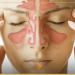 كل ما تحتاج معرفته عن التهاب الجيوب الأنفية كل ما تحتاج معرفته عن التهاب الجيوب الأنفية