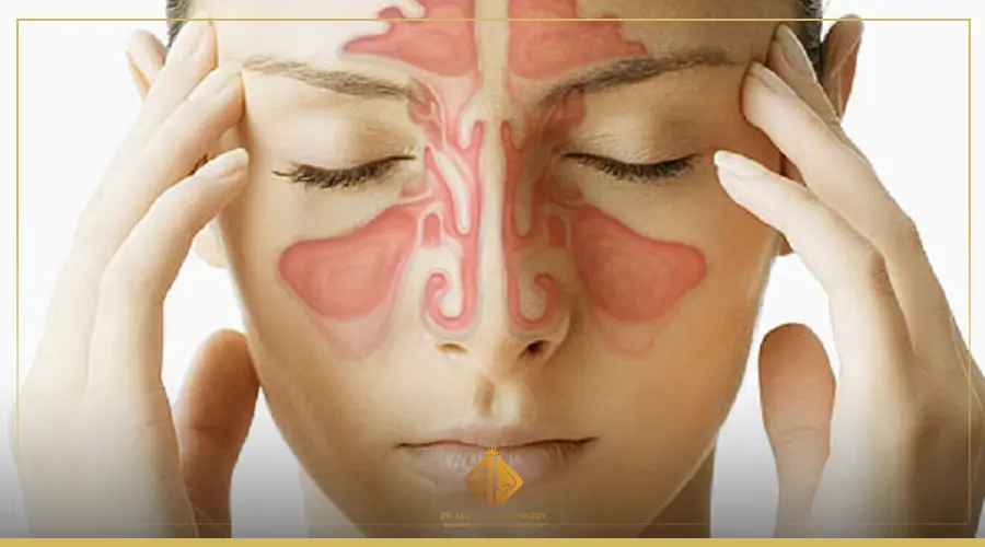 كل ما تحتاج معرفته عن التهاب الجيوب الأنفية كل ما تحتاج معرفته عن التهاب الجيوب الأنفية