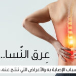 كل ما تحتاج معرفته عن عرق النسا: الأسباب والعلاج كل ما تحتاج معرفته عن عرق النسا: الأسباب والعلاج