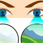 كل ما تحتاج معرفته عن كسل العين: الأسباب والأعراض والعلاج كل ما تحتاج معرفته عن كسل العين: الأسباب والأعراض والعلاج