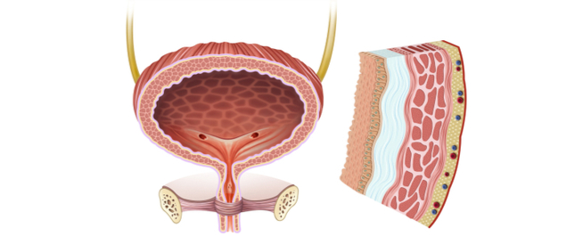 أسباب وعلاجات فعالة لإلتهاب المثانة: دليل شامل أسباب وعلاجات فعالة لإلتهاب المثانة: دليل شامل