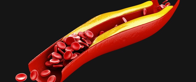 ما يجب معرفته عن الكوليسترول المرتفع وأسبابه ما يجب معرفته عن الكوليسترول المرتفع وأسبابه