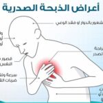 كل ما تحتاج معرفته عن الذبحة الصدرية كل ما تحتاج معرفته عن الذبحة الصدرية