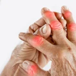 فهم شامل لمرض الروماتويد وأسبابه وعلاجه فهم شامل لمرض الروماتويد وأسبابه وعلاجه