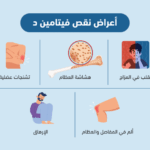 نقص فيتامين د: الأعراض، الأسباب، والعلاج بالتفصيل نقص فيتامين د: الأعراض، الأسباب، والعلاج بالتفصيل
