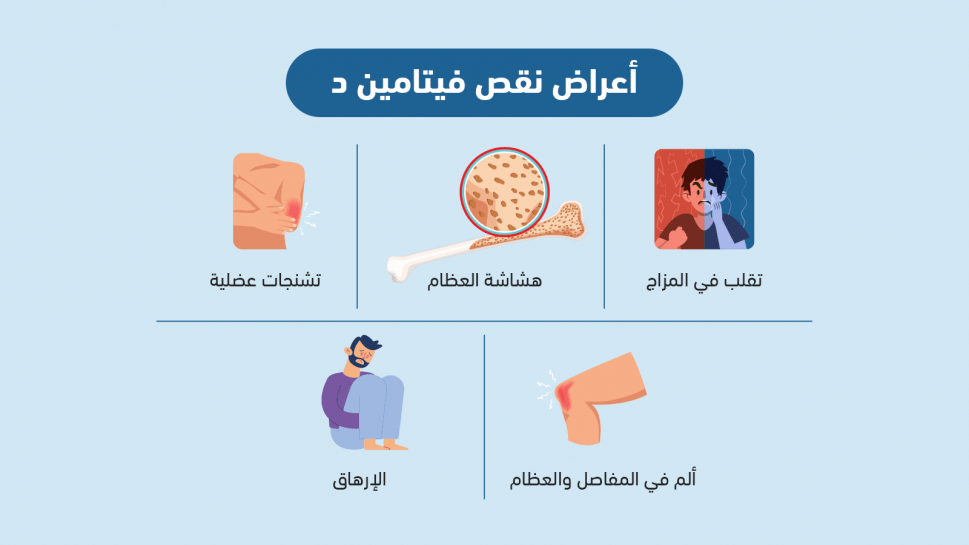 نقص فيتامين د: الأعراض، الأسباب، والعلاج بالتفصيل نقص فيتامين د: الأعراض، الأسباب، والعلاج بالتفصيل