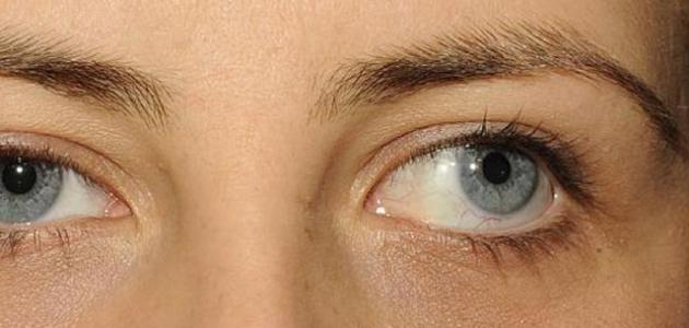 كل ما تحتاج معرفته عن انحراف النظر وأسبابه كل ما تحتاج معرفته عن انحراف النظر وأسبابه