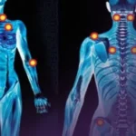 كل ما تحتاج لمعرفته عن الفايبروميالجيا: التشخيص والعلاج كل ما تحتاج لمعرفته عن الفايبروميالجيا: التشخيص والعلاج